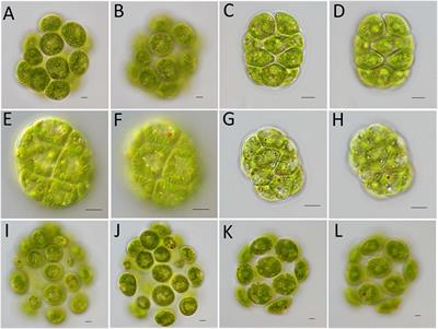 Evolutionary Analysis of Unicellular Species in Chlamydomonadales Through Chloroplast <mark class="highlighted">Genome Comparison</mark> With the Colonial Volvocine Algae
